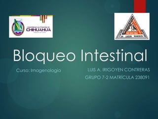 Bloqueo Intestinal
Curso: Imagenología    LUIS A. IRIGOYEN CONTRERAS
                      GRUPO 7-2 MATRÍCULA 238091
 