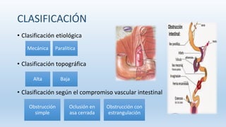 CLASIFICACIÓN
• Clasificación etiológica
• Clasificación topográfica
• Clasificación según el compromiso vascular intestinal
Mecánica Paralitica
Alta Baja
Obstrucción
simple
Oclusión en
asa cerrada
Obstrucción con
estrangulación
 