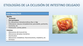 ILEO PARALITICO
Agudas
• Peritonitis
• Post quirúrgicas
• Por alteraciones hidroelectrolíticas (Na, K, Mg)
• Inflamatorio: absceso intraabdominal, pancreatitis, peritonitis,
neumonia, etc.
• Intoxicación: uremia, plomo
Crónicas
• Alteraciones del musculo liso
• Alteraciones del plexo mientérico
• Diverticulosis
• Alteraciones metabólicas: feocromocitoma, mixedema, etc
• Fármacos
ETIOLOGÍAS DE LA OCLUSIÓN DE INTESTINO DELGADO
 