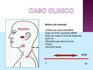 Motivo de consulta:
Cefalea de intensidad 8/10
Dolor en ATM izquierda 10/10
Dolor en cuello a nivel de trapecios
de 8-10.
Dificultad para abrir la boca.
Tinitus.
Asimetria facial

10/10

1

10

 