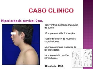 Hiperlordosis cervical 9cm.
•Desventaja mecánica músculos
de cuello.

•Compresión atlanto-occipital.
•Sobredistensión de músculos
suprahioideos.

•Aumento de tono muscular de
los elevadores.
•Aumento de la presión
intraarticular.

Rocabado, 1995.

 