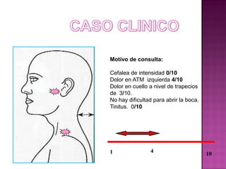 Motivo de consulta:
Cefalea de intensidad 0/10
Dolor en ATM izquierda 4/10
Dolor en cuello a nivel de trapecios
de 3/10.
No hay dificultad para abrir la boca.
Tinitus. 0/10

1

4

10

 