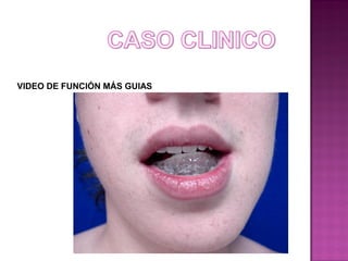 VIDEO DE FUNCIÓN MÁS GUIAS

 