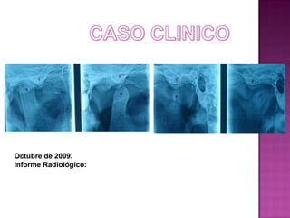 Octubre de 2009.
Informe Radiológico:

 