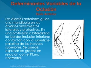  Los dientes anteriores guían
a la mandíbula en los
diversos movimientos
laterales y protrusivos. En
una protrusión o lateralidad
los bordes incisales inferiores
contactan con la superficie
palatina de los incisivos
superiores. Se puede
expresar en grados en
relación con el Plano
Horizontal.
C.D.RAUL MARTINEZ APARICIO-ramartinez60@hotmail.com
 