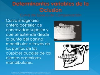  Curva imaginaria
antero posterior de
concavidad superior y
que se extiende desde
la punta del canino
mandibular a través de
las puntas de las
cúspides bucales de los
dientes posteriores
mandibulares.
C.D.RAUL MARTINEZ APARICIO-ramartinez60@hotmail.com
 