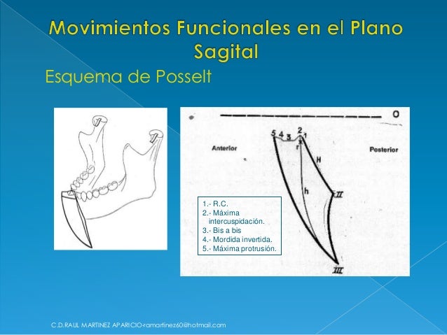 Oclusion