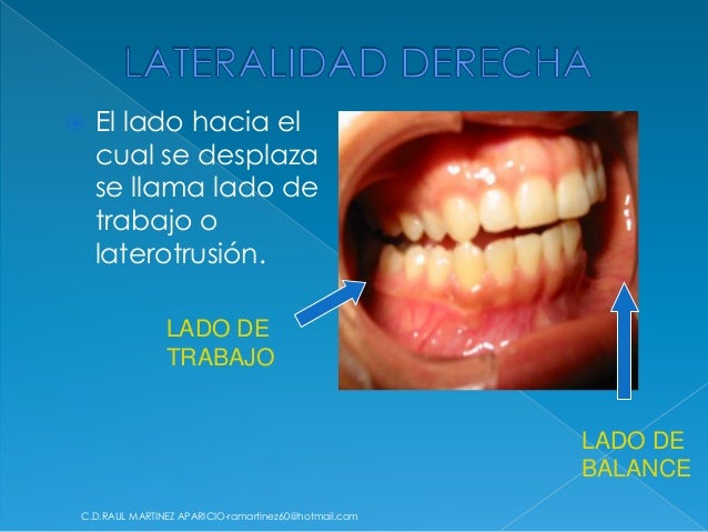 Oclusion