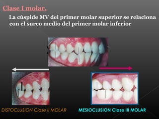Oclusion dental | PPT