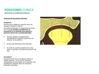 POSICION DE RELACION CENTRICA
Anatómica:
Posición que establece la relación entre los
maxilares superior e inferior.
Esta determinada por el componente articular,
en lo cual los cóndilos mandibulares se
encuentren en su posición mas superior y
posterior dentro de la cavidad glenoidea
 Posicion condilar completamente
asentada Sin importar la posición con
relacion de los dientes
 El disco del ATM debe estar Alineado
 En la RC los condilos pueden estar rotar
sobre un eje fijo a una apertura aprox de 20
mm.
Conceptual
Aquella posición de la mandíbula relativa al
maxilar superior , en la cual los músculos
masticatorios se encuentran en su posición mas
equilibrada y relajada, libres de tensiones
verticales o laterales.
POSICIONES CLINICA
Posiciones mandibulares básicas
 