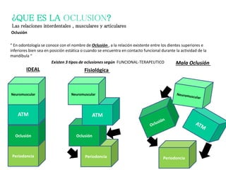 ¿QUE ES LA OCLUSION?
Las relaciones interdentales , musculares y articulares
Oclusión
“ En odontología se conoce con el nombre de Oclusión , a la relación existente entre los dientes superiores e
inferiores bien sea en posición estática o cuando se encuentra en contacto funcional durante la actividad de la
mandíbula “
Existen 3 tipos de oclusiones según FUNCIONAL-TERAPEUTICO
Periodoncia
Oclusión
ATM
Neuromuscular
Periodoncia
Oclusión
ATM
Neuromuscular
Periodoncia
IDEAL Fisiológica
Mala Oclusión
 