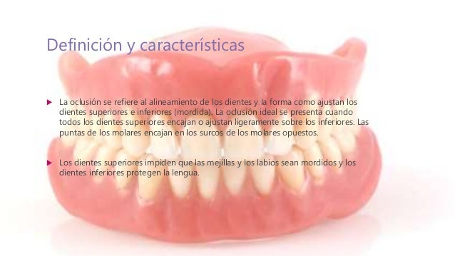 Oclusion dental