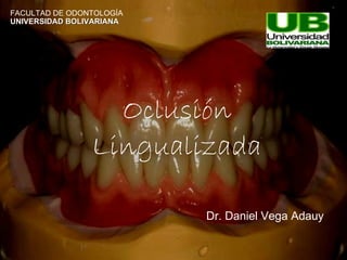 Oclusión Lingualizada FACULTAD DE ODONTOLOGÍA UNIVERSIDAD BOLIVARIANA Dr. Daniel Vega Adauy 