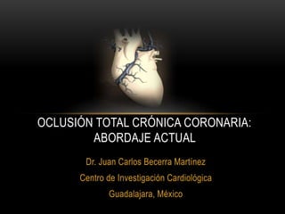 Dr. Juan Carlos Becerra Martínez
Centro de Investigación Cardiológica
Guadalajara, México
OCLUSIÓN TOTAL CRÓNICA CORONARIA:
ABORDAJE ACTUAL
 