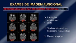 EXAMES DE IMAGEM FUNCIONAL
RESSONÂNCIA NUCLEAR MAGNÉTICA FUNCIONAL (fMRI)
 Limitações:
• movimentos
• custo
 Tarefas mais possíveis:
linguagem, visão, audição
 Uso em pesquisas
 