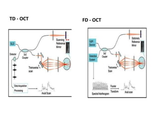 Optical coherence tomography | PPTX