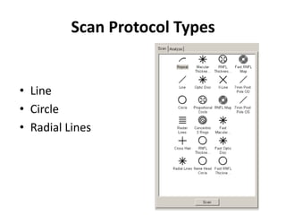 Optical coherence tomography | PPTX