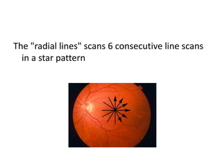 Optical coherence tomography | PPTX
