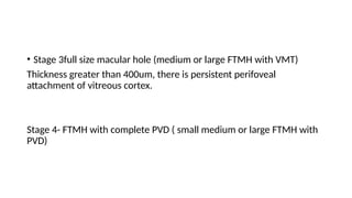Optical Coherence Tomography Basic Details | PPTX
