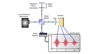 Optical Coherence Tomography Basic Details | PPTX