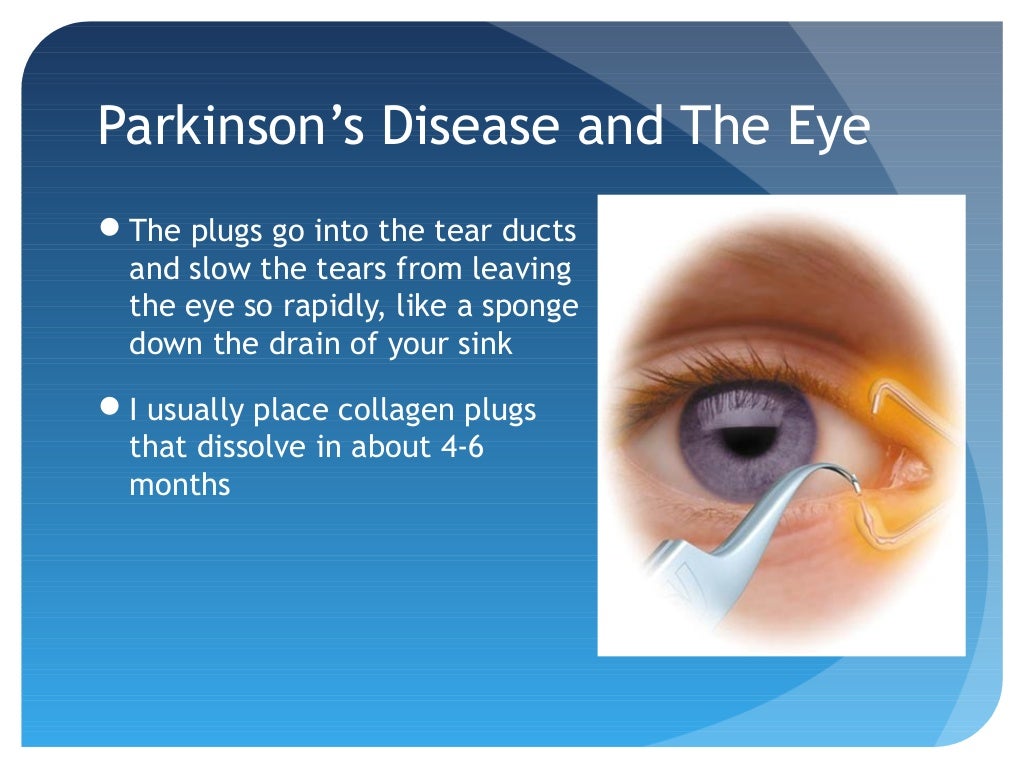 Parkinson's Disease and the Eye