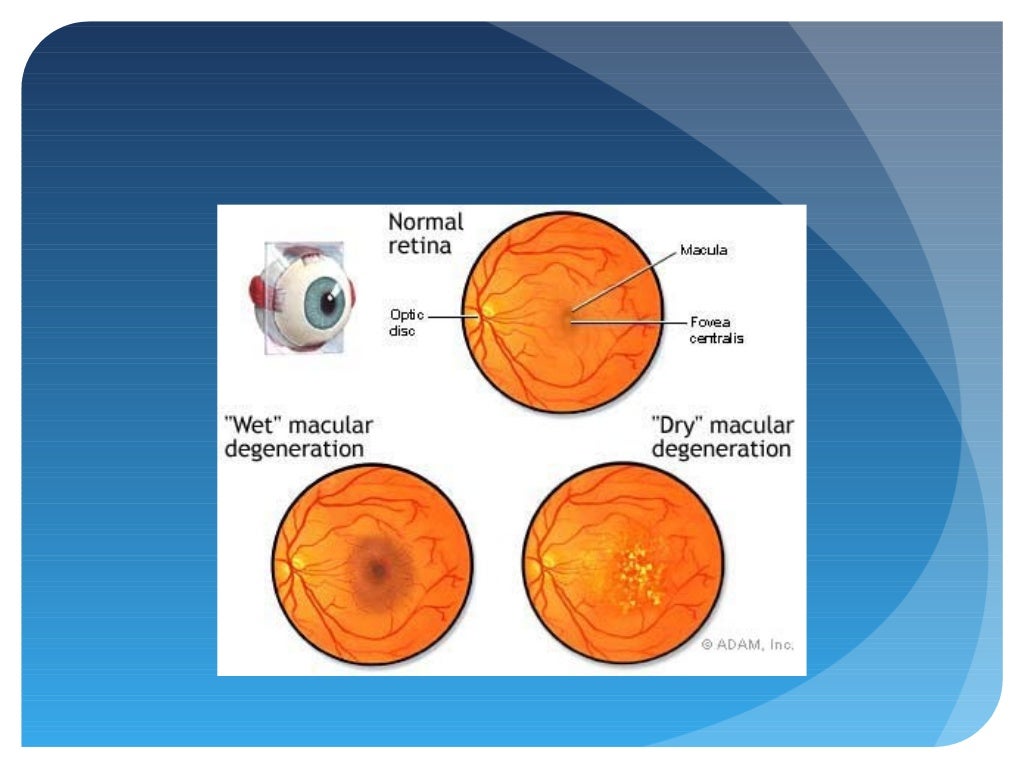 Parkinson's Disease and the Eye