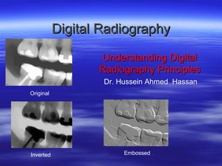 Digital Radiography
Understanding Digital
Radiography Principles
Dr. Hussein Ahmed Hassan
Original

Inverted

Embossed

 