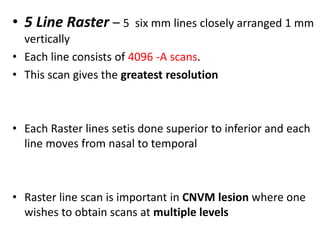 Octmac 5 Line Raster OCT | PPTX