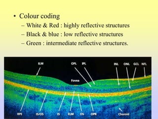 • Colour coding
– White & Red : highly reflective structures
– Black & blue : low reflective structures
– Green : intermediate reflective structures.
 