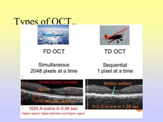 Types of OCT..
 