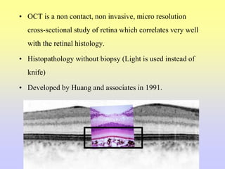 • OCT is a non contact, non invasive, micro resolution
cross-sectional study of retina which correlates very well
with the retinal histology.
• Histopathology without biopsy (Light is used instead of
knife)
• Developed by Huang and associates in 1991.
 