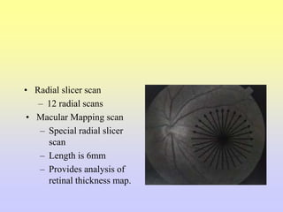 • Radial slicer scan
– 12 radial scans
• Macular Mapping scan
– Special radial slicer
scan
– Length is 6mm
– Provides analysis of
retinal thickness map.
 