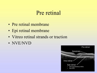Pre retinal
• Pre retinal membrane
• Epi retinal membrane
• Vitreo retinal strands or traction
• NVE/NVD
 