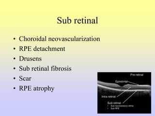 Sub retinal
• Choroidal neovascularization
• RPE detachment
• Drusens
• Sub retinal fibrosis
• Scar
• RPE atrophy
 