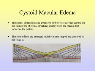 Cystoid Macular Edema
• The shape, dimensions and extension of the cystic cavities depend on
the framework of retinal structures and layers in the macula that
influence the pattern.
• The Henle fibers are arranged radially in star shaped and centered on
the foveola.
 