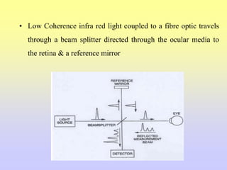 • Low Coherence infra red light coupled to a fibre optic travels
through a beam splitter directed through the ocular media to
the retina & a reference mirror
 