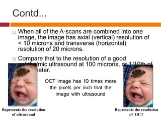 Contd...
 When all of the A-scans are combined into one
image, the image has axial (vertical) resolution of
< 10 microns and transverse (horizontal)
resolution of 20 microns.
 Compare that to the resolution of a good
ophthalmic ultrasound at 100 microns, or 1/10th of
a millimeter.
Represents the resolution
of ultrasound
Represents the resolution
of OCT
OCT image has 10 times more
the pixels per inch that the
image with ultrasound
 