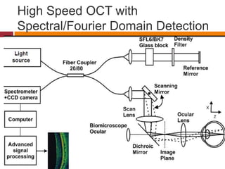High Speed OCT with
Spectral/Fourier Domain Detection
 