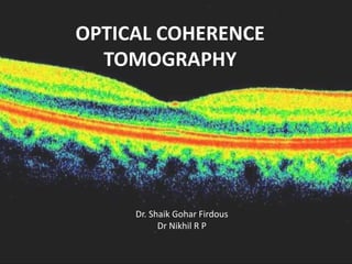OPTICAL COHERENCE
TOMOGRAPHY
Dr. Shaik Gohar Firdous
Dr Nikhil R P
 