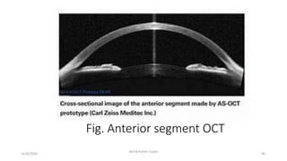 Optical Ct Scan Optical coherence tomography | PPTX