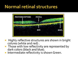 Optical Coherence Tomography (OCT) | PPTX