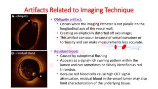 Oct Artefact Example OCT.pptx