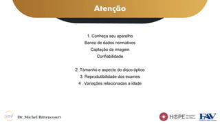 Atenção
1. Conheça seu aparelho
Banco de dados normativos
Captação da imagem
Confiabilidade
2. Tamanho e aspecto do disco óptico
3. Reprodutibilidade dos exames
4 . Variações relacionadas a idade
 
