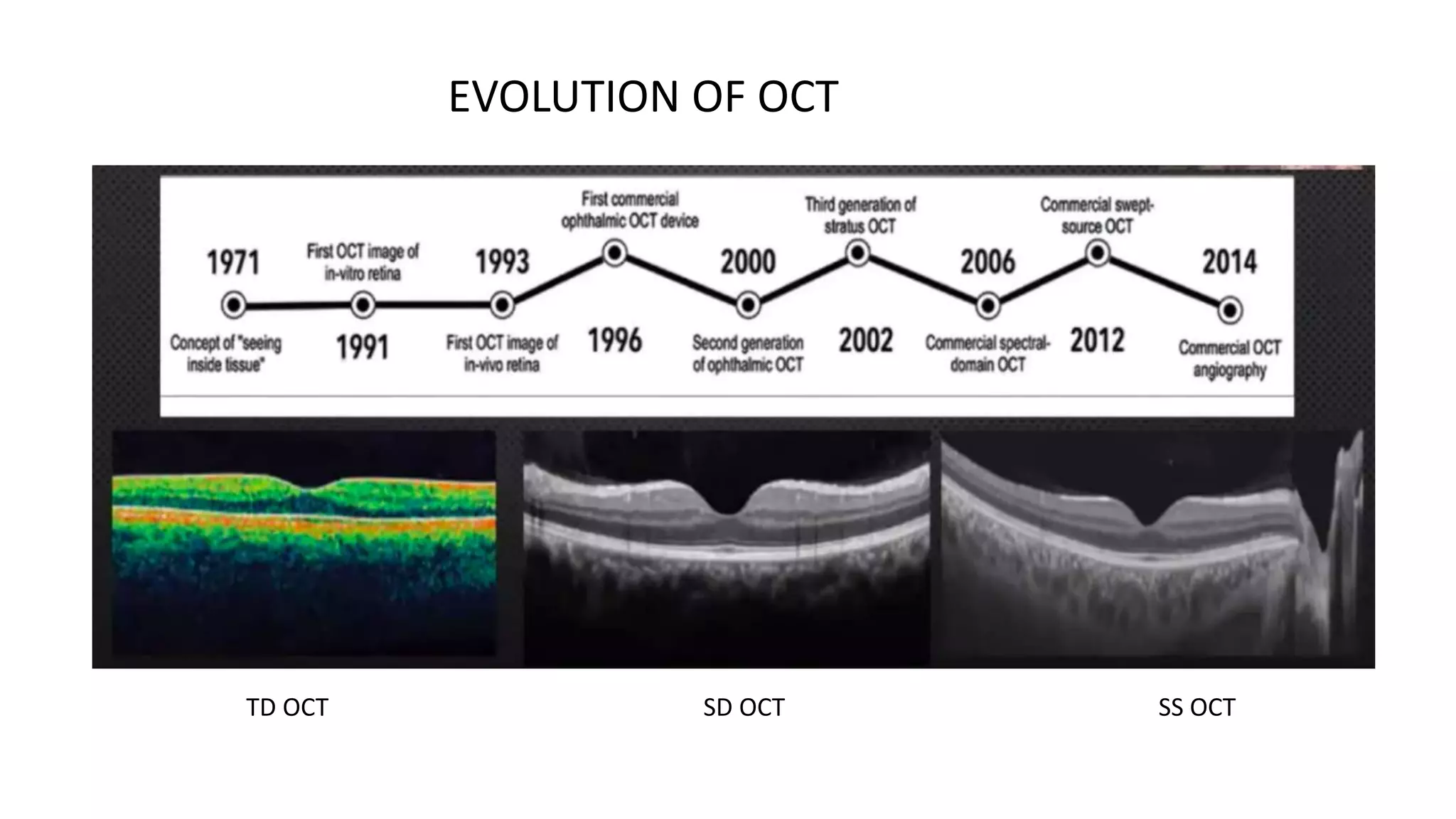 TD OCT SD OCT SS OCT
EVOLUTION OF OCT
 