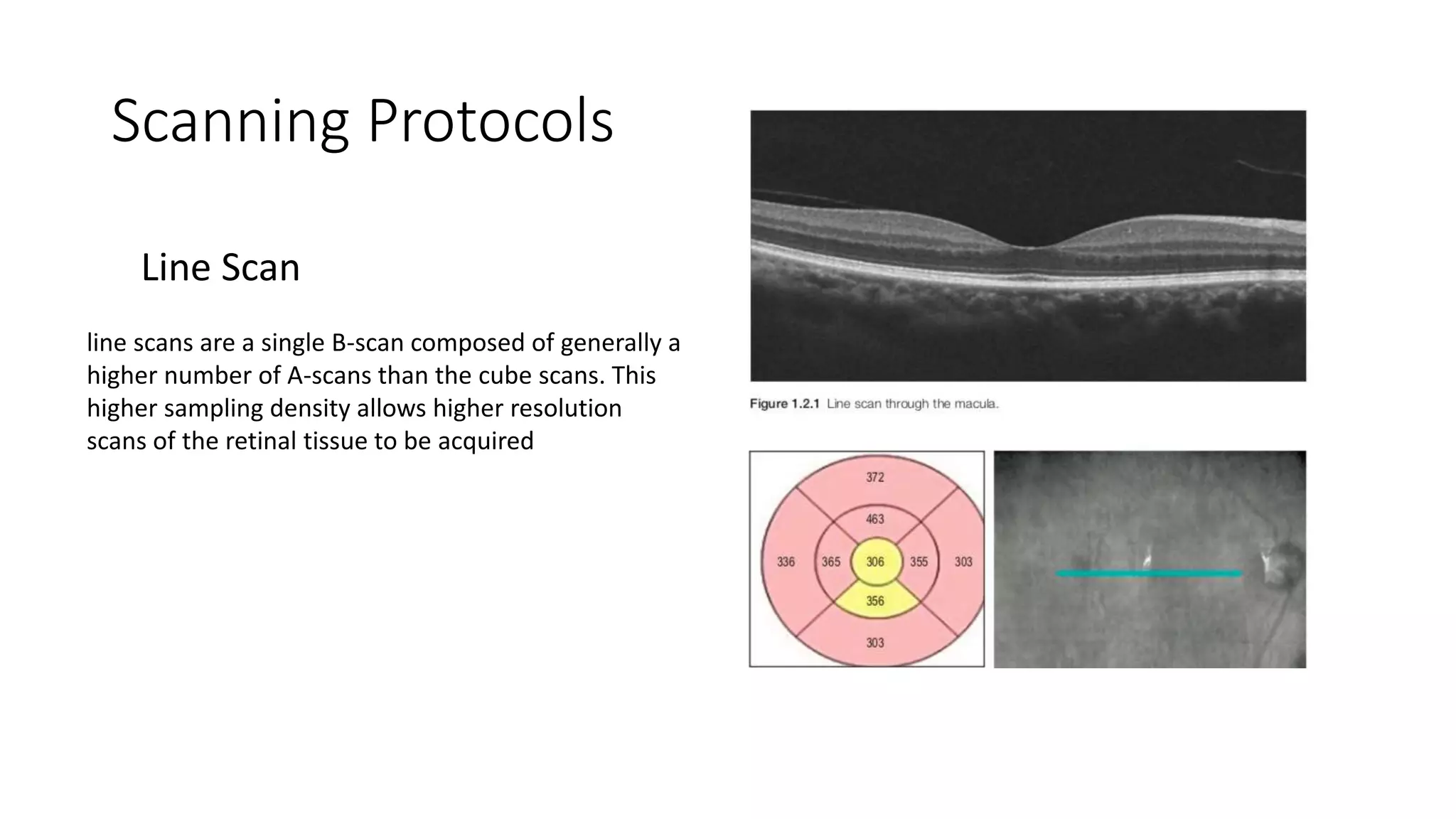 Scanning Protocols
line scans are a single B-scan composed of generally a
higher number of A-scans than the cube scans. This
higher sampling density allows higher resolution
scans of the retinal tissue to be acquired
Line Scan
 