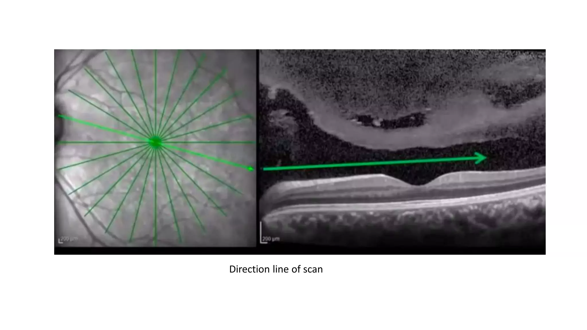 Direction line of scan
 