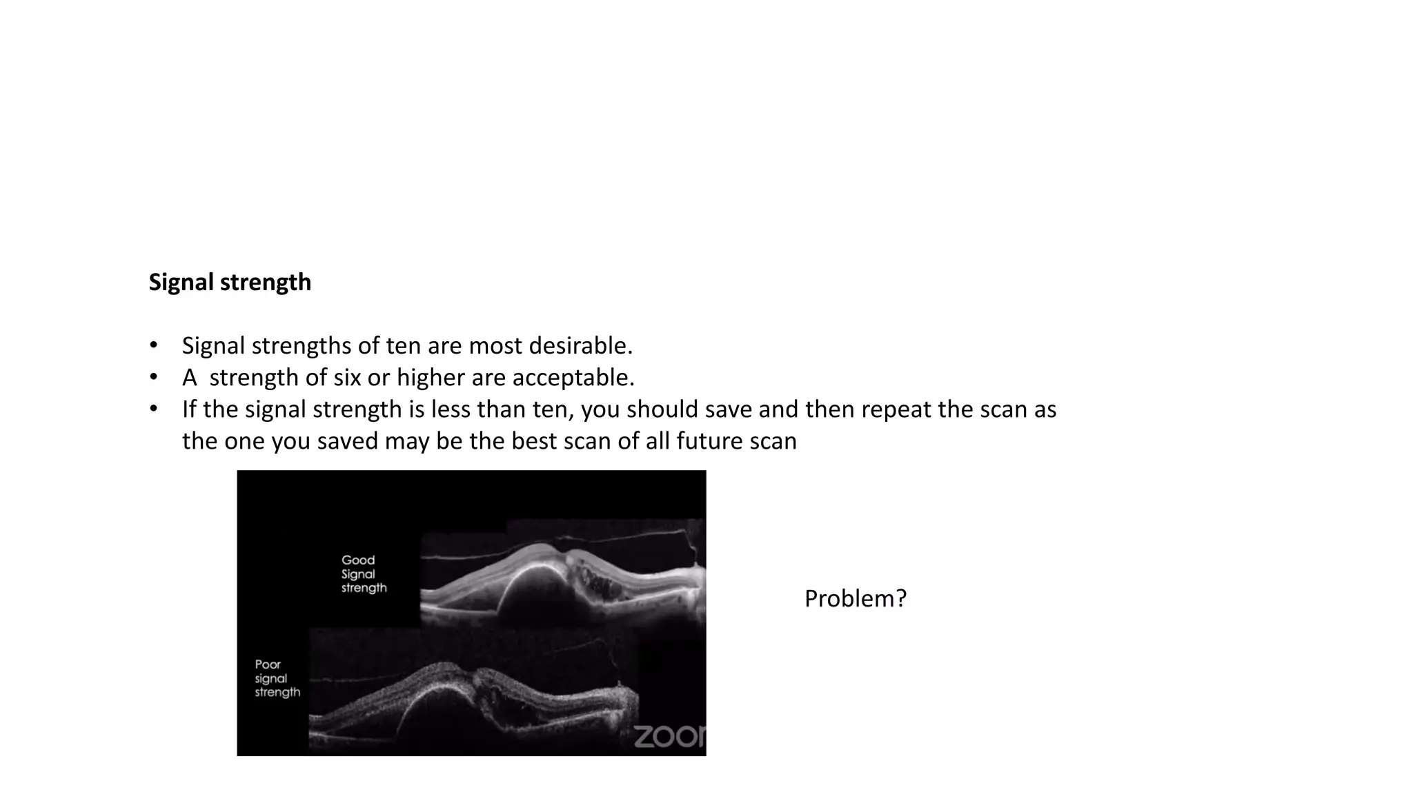 Signal strength
• Signal strengths of ten are most desirable.
• A strength of six or higher are acceptable.
• If the signal strength is less than ten, you should save and then repeat the scan as
the one you saved may be the best scan of all future scan
Problem?
 
