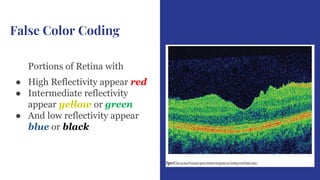 Optical coherence tomography in Ophthalmology.pptx