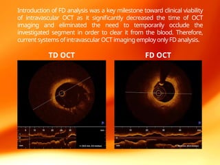 Hemo System Oct OCT in intervention cardiology managment.pptx