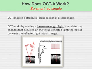 How Does OCT-A Work?
So smart, so simple
OCT image is a structural, cross-sectional, B-scan image.
OCT works by sending a long-wavelength light, then detecting
changes that occurred on the tissue-reflected light; thereby, it
converts the reflected light into an image.
 